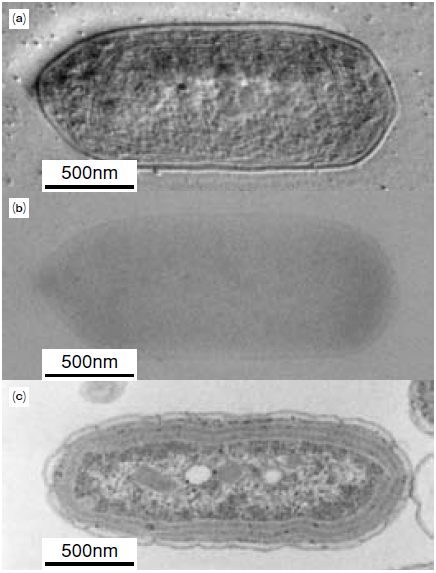 図4 ヒルベルト微分法による 　　 シアノバクテリアの電子顕微鏡観察像※2